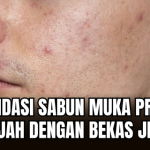 Sabun Cuci Muka Pria untuk Bekas Jerawat