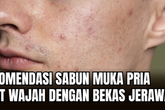 Sabun Cuci Muka Pria untuk Bekas Jerawat