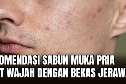Sabun Cuci Muka Pria untuk Bekas Jerawat