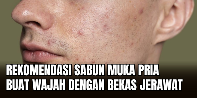 Sabun Cuci Muka Pria untuk Bekas Jerawat