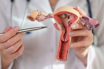 Kesehatan Reproduksi Wanita