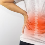 Cara Menjaga Kesehatan Tulang Punggung Dengan Benar Menurut Dokter